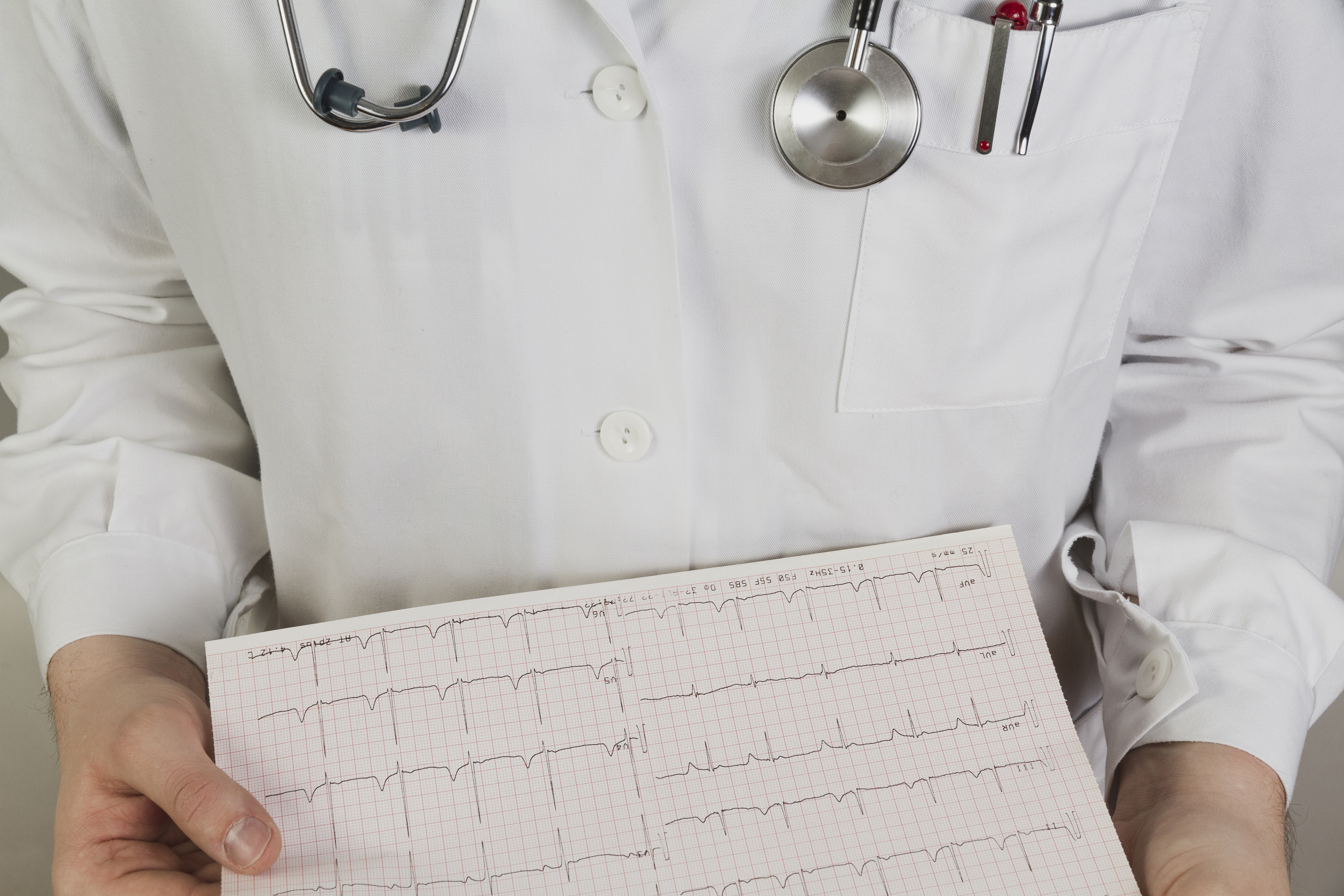 Electrocardiograma Sin Costo